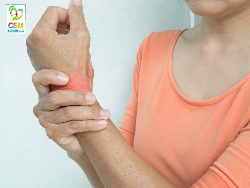 Nguyen nhan dau khop co tay la gi Nguyên nhân gây đau khớp cổ tay