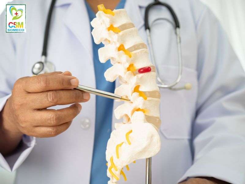 Nguyen nhan gay thoat vi dia dem Nguyên nhân nào gây ra thoát vị đĩa đệm.