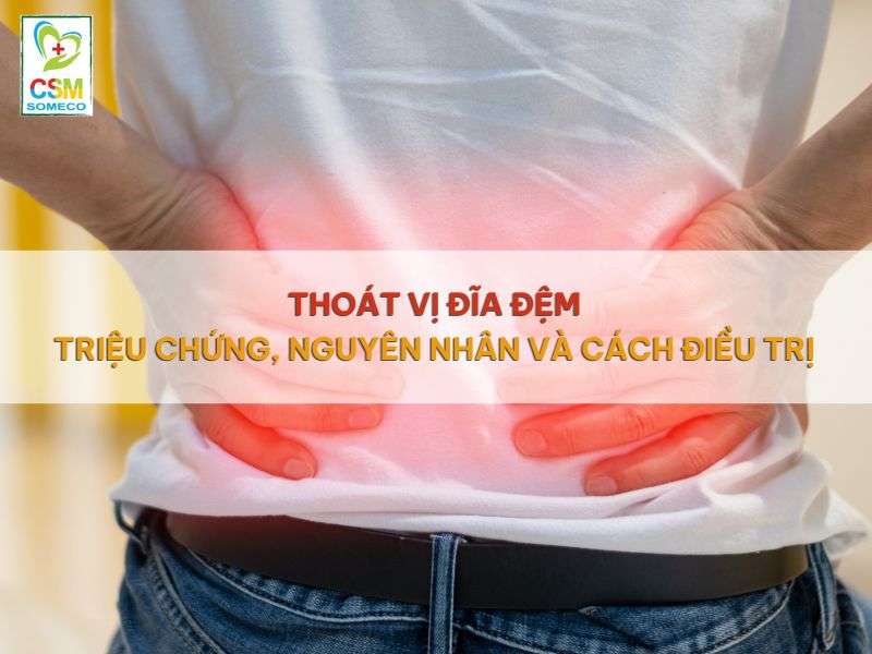 Thoat vi dia dem trieu chung nguyen nhan va cach dieu tri Thoát vị đĩa đệm