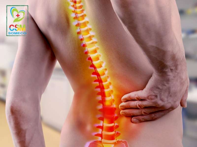 cac benh ly co xuong khop Bệnh lý cơ xương khớp nên kéo giãn cột sống