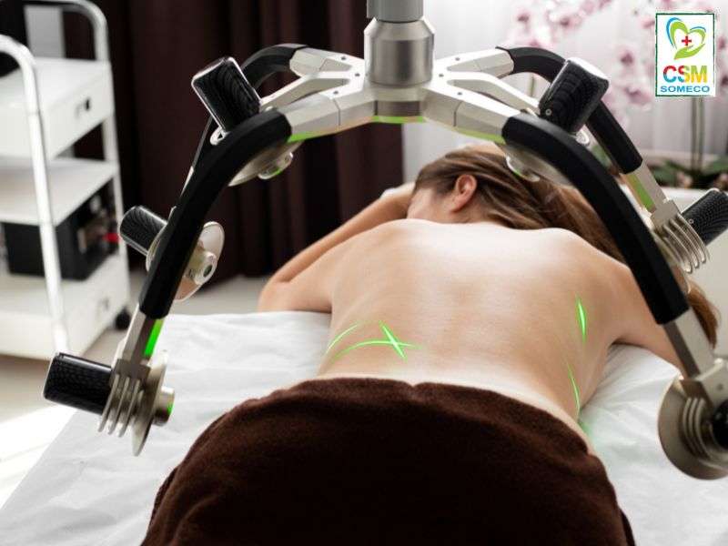 Lieu phap laser cuong do thap Liệu pháp laser cường độ thấp.