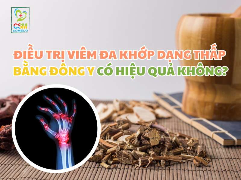 dieu tri viem da khop dang thap bang dong y co hieu qua khong Điều trị viêm đa khớp dạng thấp bằng đông y