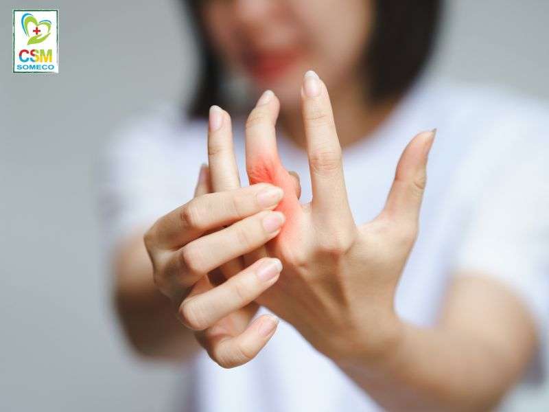 Viem khop dang thap la gi Khi nao can di kham ngay Viêm khớp dạng thấp là gì.