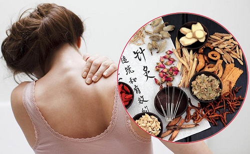 Bí Quyết Chữa Trị Đau Vai Gáy Theo Y Học Cổ Truyền