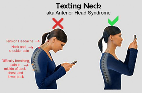 Tư thế Tech Neck