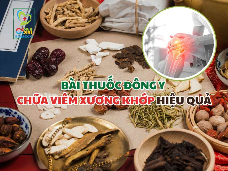 bai thuoc dong y chua viem xuong khop Bài thuốc đông y chữa viêm xương khớp