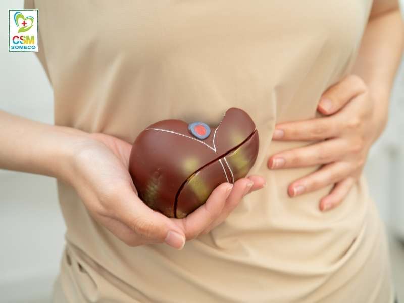 cach nao phong ngua gan nhiem mo cap do Cách nào phòng ngừa gan nhiễm mỡ cấp độ 2?