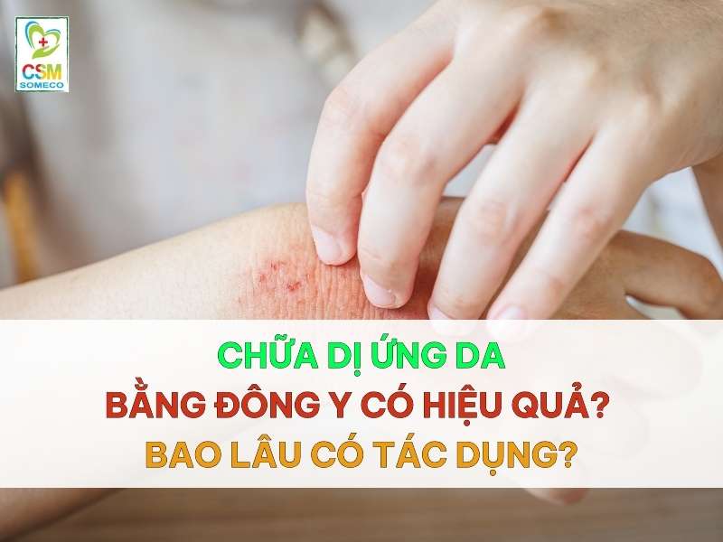 chua di ung da bang dong y co hieu qua bao lau co tac dung Chữa dị ứng da bằng đông y có hiệu quả?