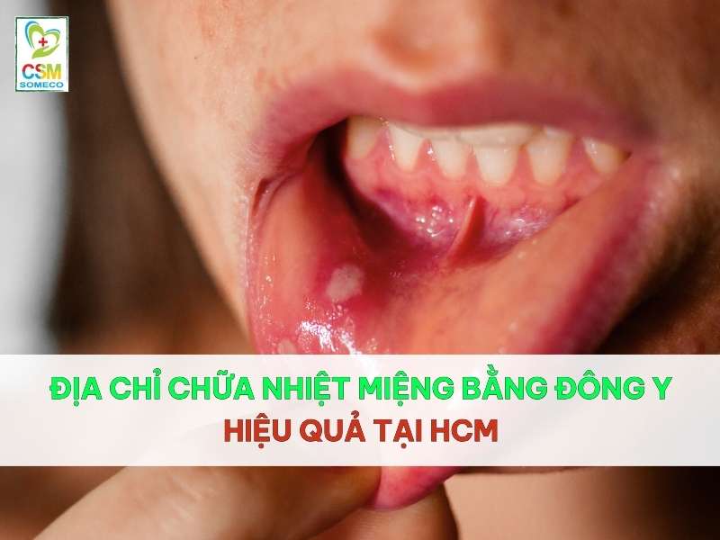 dia chi chua nhiet mieng bang dong y hieu qua tai hcm hữa nhiệt miệng bằng đông y hiệu quả tại HCM.