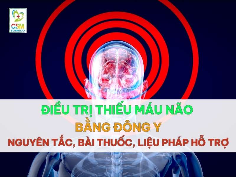 dieu tri thieu mau nao bang dong y nguyen tac bai thuoc lieu phap ho tro Điều trị thiếu máu não bằng đông y