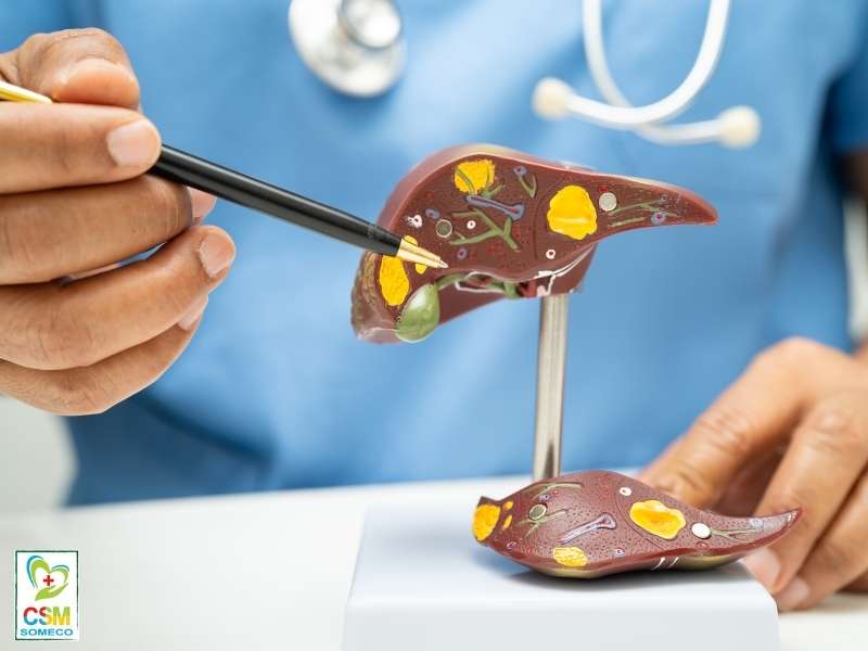 don vi nao tri gan nhiem mo cap do bang dong y hieu qua hcm Đơn vị nào trị gan nhiễm mỡ cấp độ 2 bằng đông y hiệu quả HCM?