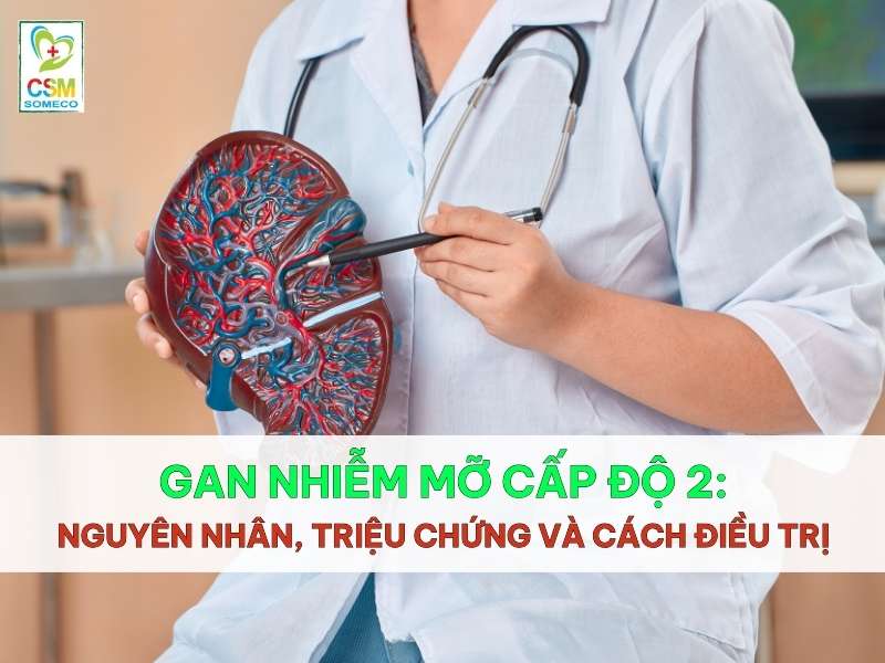 gan nhiem mo cap do nguyen nhan trieu chung va cach dieu tri Gan nhiễm mỡ cấp độ 2