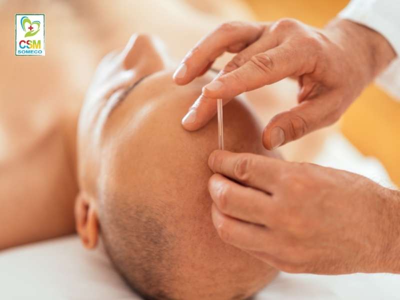 lieu phap ho tro dieu tri thieu mau nao trong dong y Châm cứu