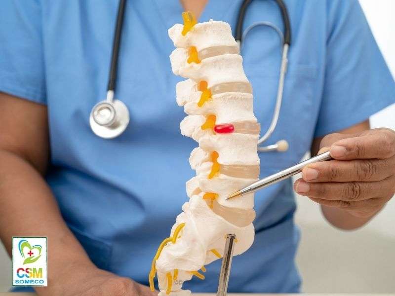 Tổng quan về đau thần kinh tọa là gì