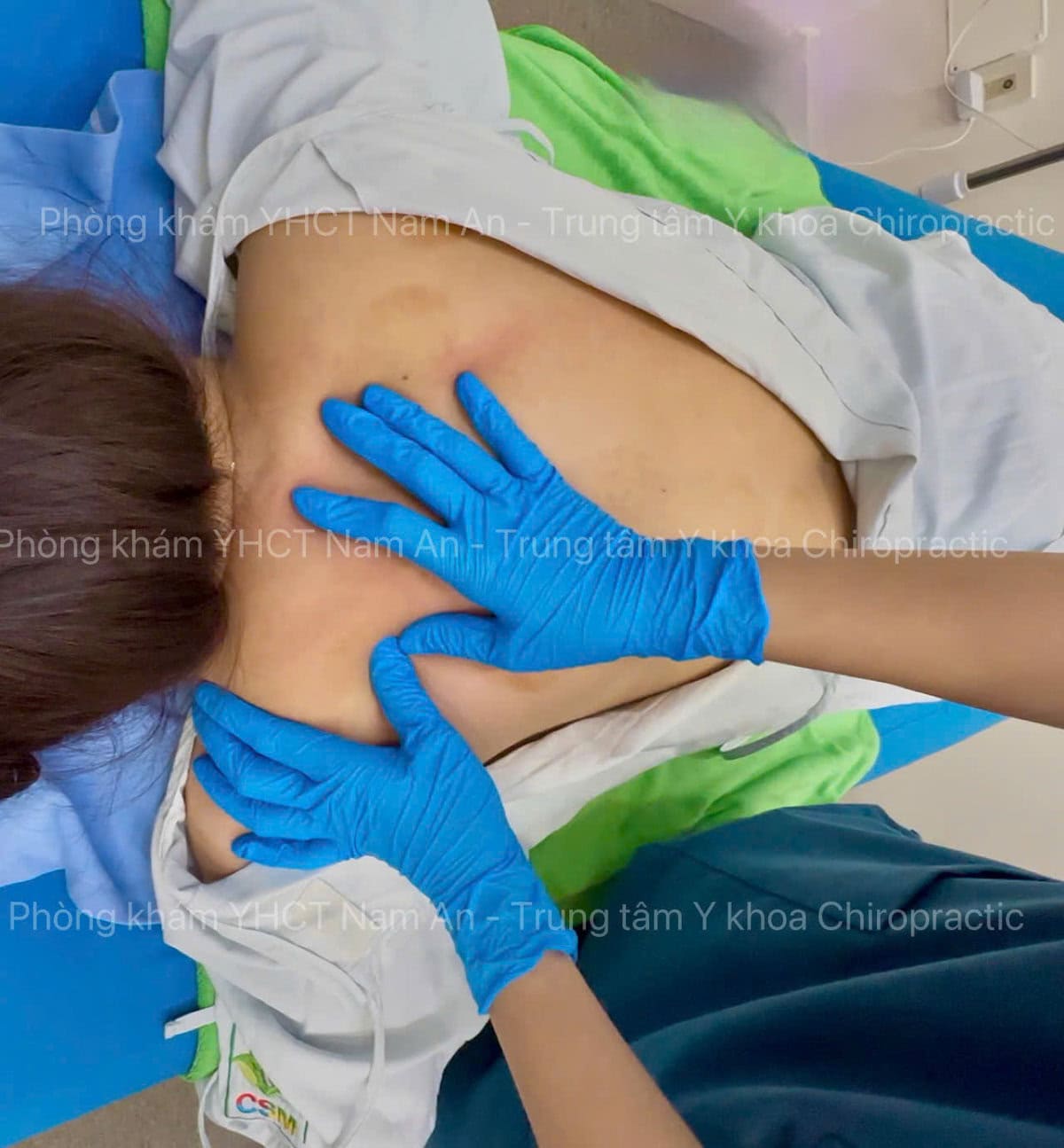 Nắn chỉnh cột sống cổ