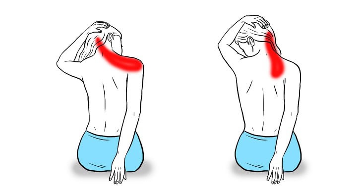 Tập Thể Dục Đúng Cách Có Thể Giúp Cải Thiện Tình Trạng Đau Đầu