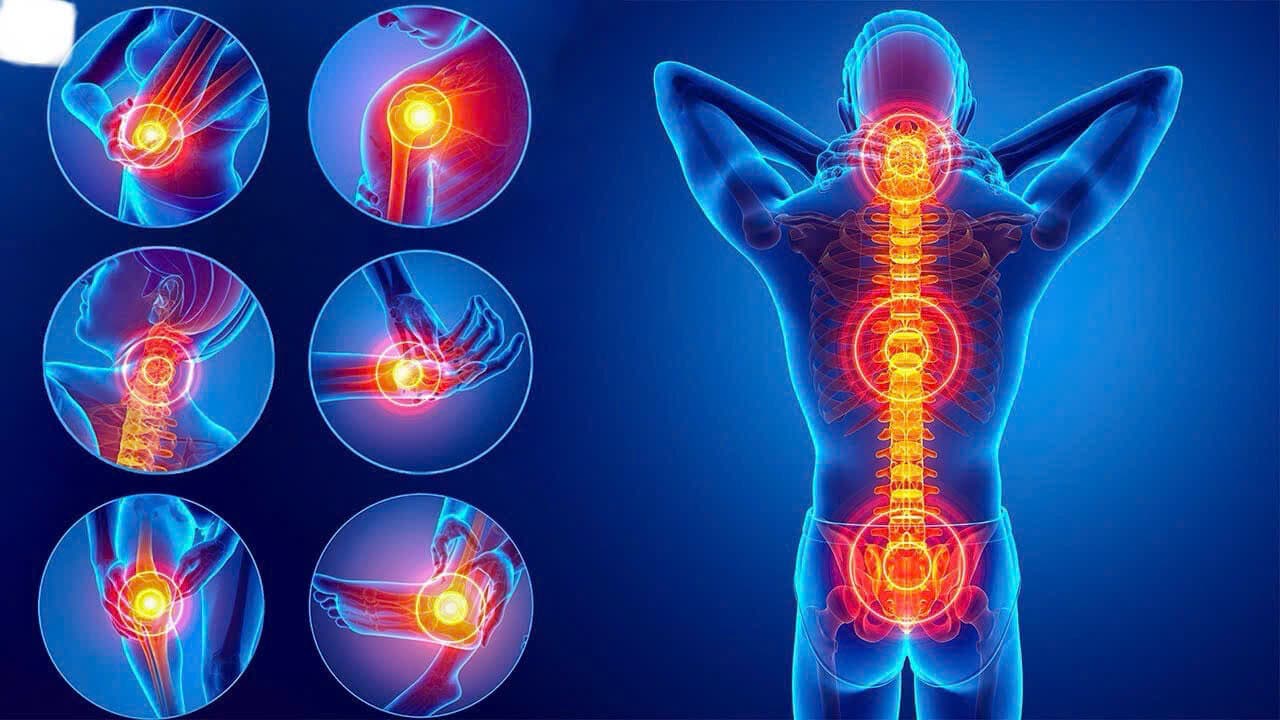 Đau Lưng Đến Thần Kinh Tọa: Chiropractic - Giải Pháp Không Dùng Thuốc, Không Phẫu Thuật