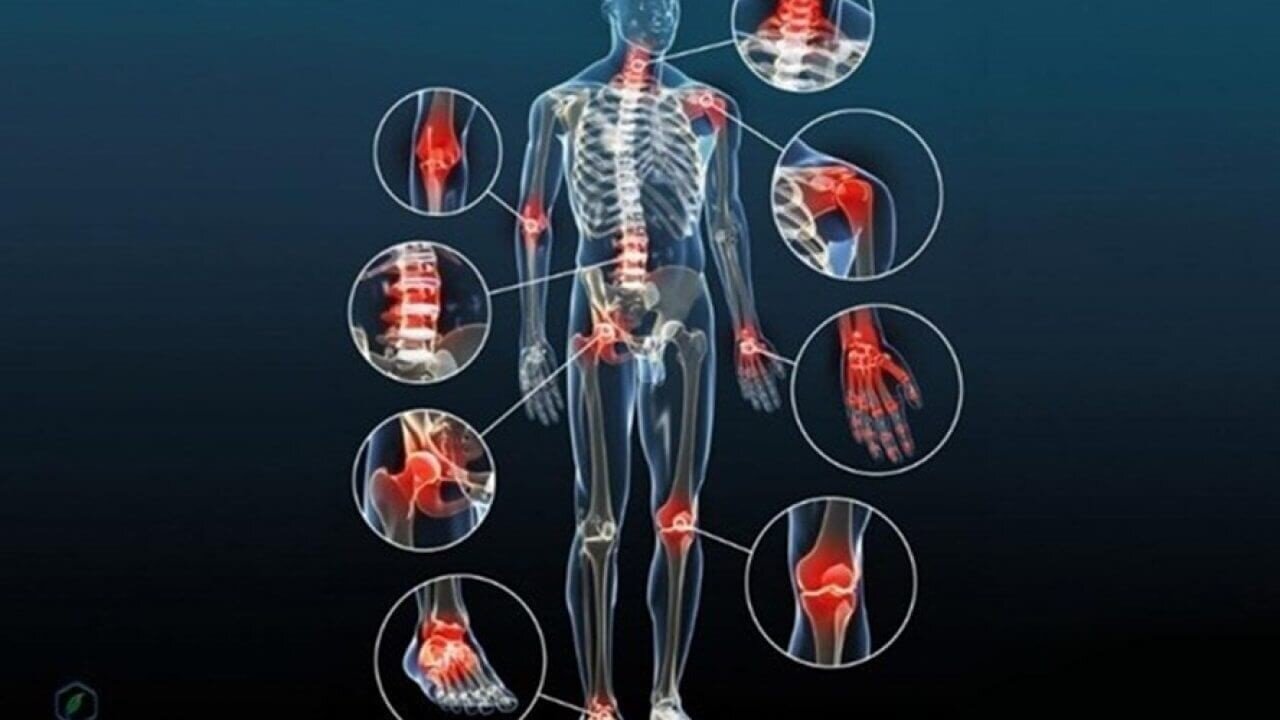 Thoái Hóa Khớp, Thoát Vị Đĩa Đệm: Chiropractic - Lựa Chọn Tối Ưu Hay Cạm Bẫy Âm Thầm?